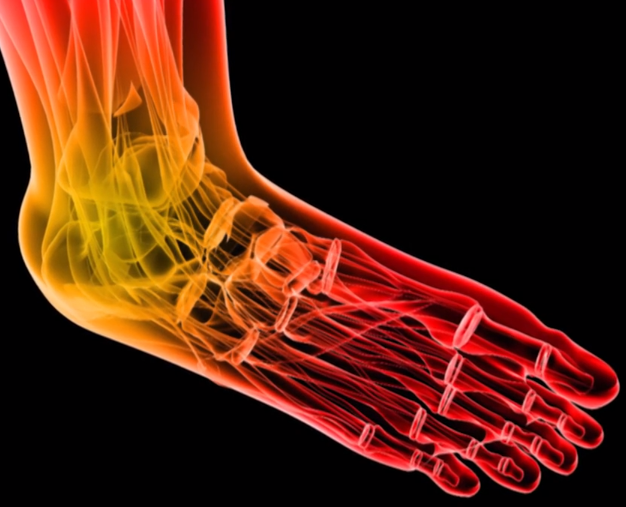 Peripheral Neuropathy | Corrigan Podiatry